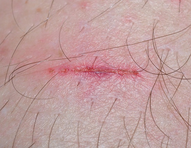 personal-injury-lawyer-640x480-55764537.jpeg