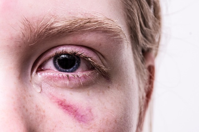 injury lawyer
