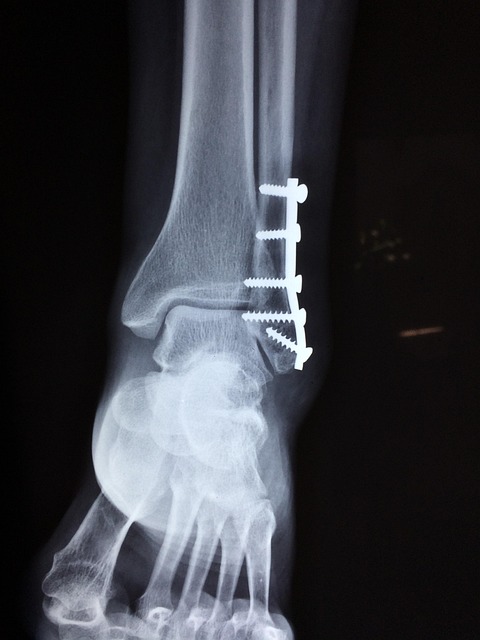 Orlando Catastrophic Injury Lawyer: Understanding Rights & Compensation