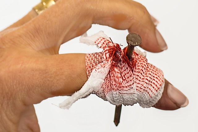 personal-injury-640x480-12989455.jpeg