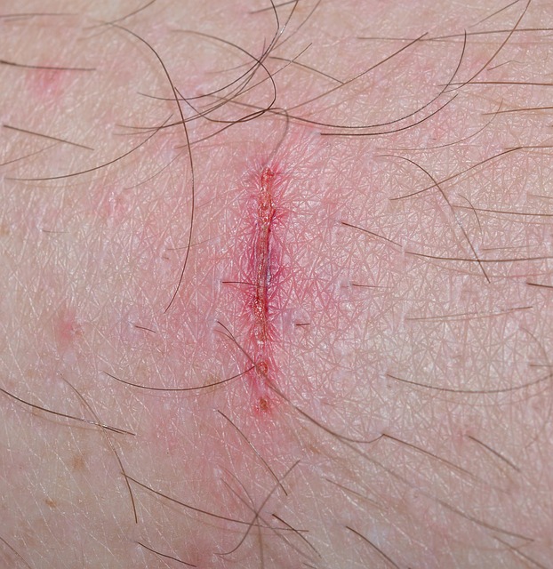 injury lawyer
