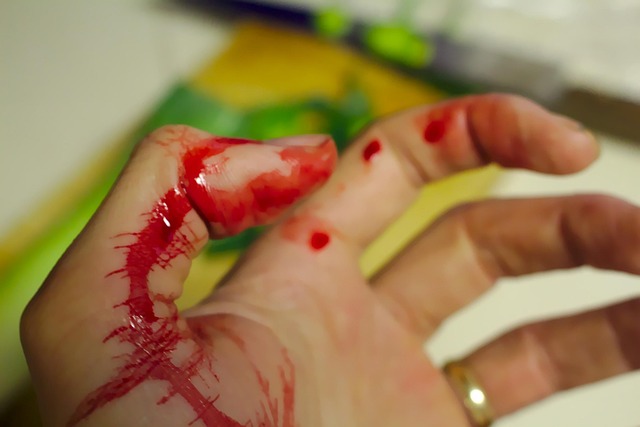 personal injury