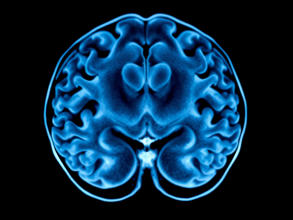 Mri brain scan — brain injury lawyer phoenix