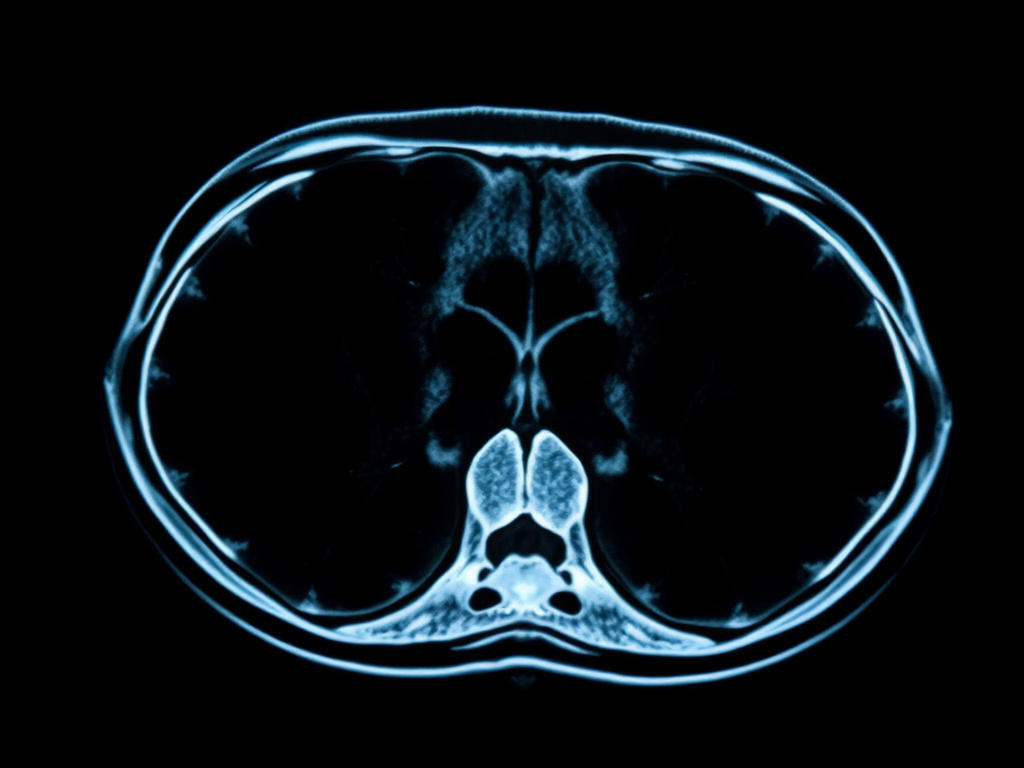 Mri scan image — brain injury lawyer phoenix