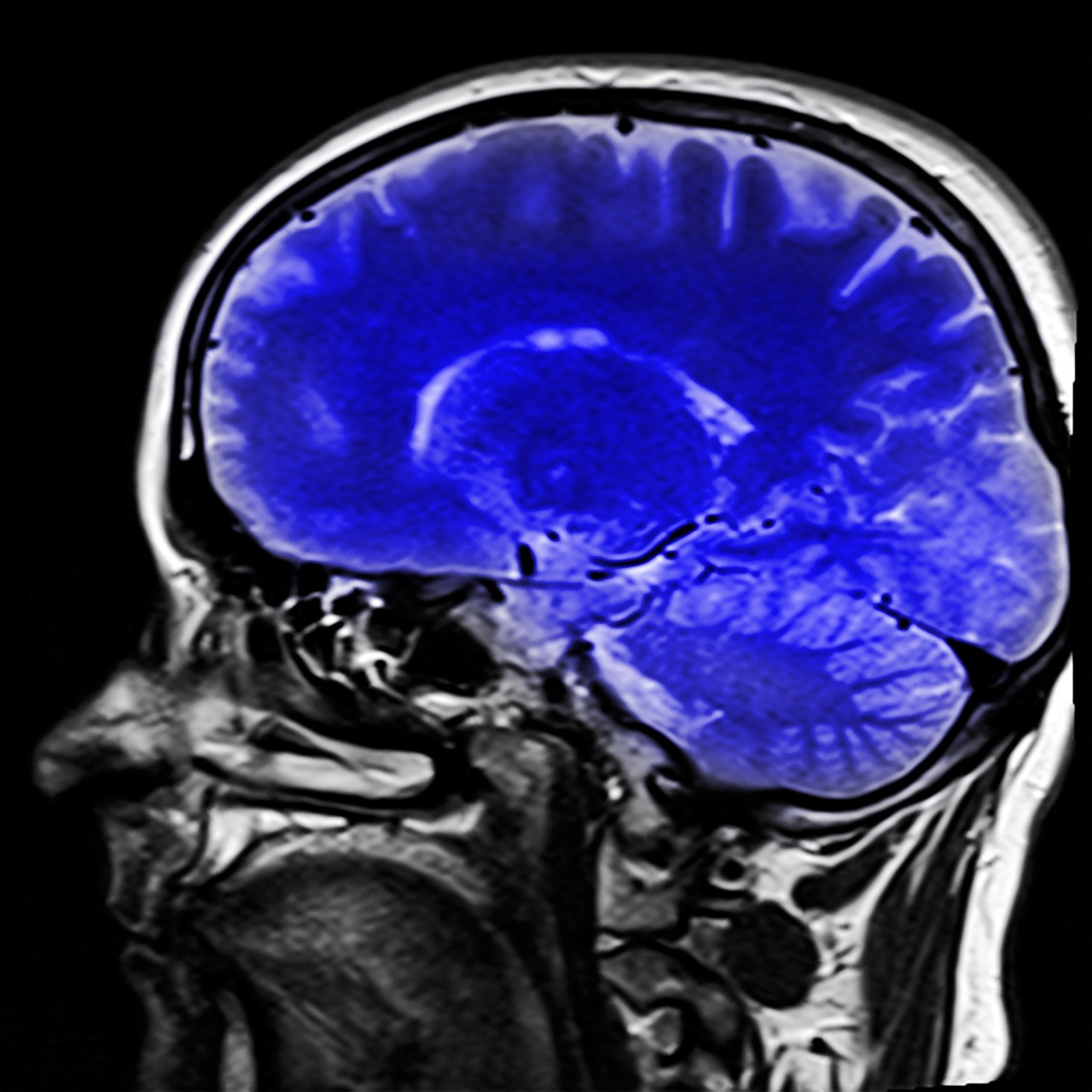 Expert Brain Injury Lawyer in Phoenix: Your Legal Ally