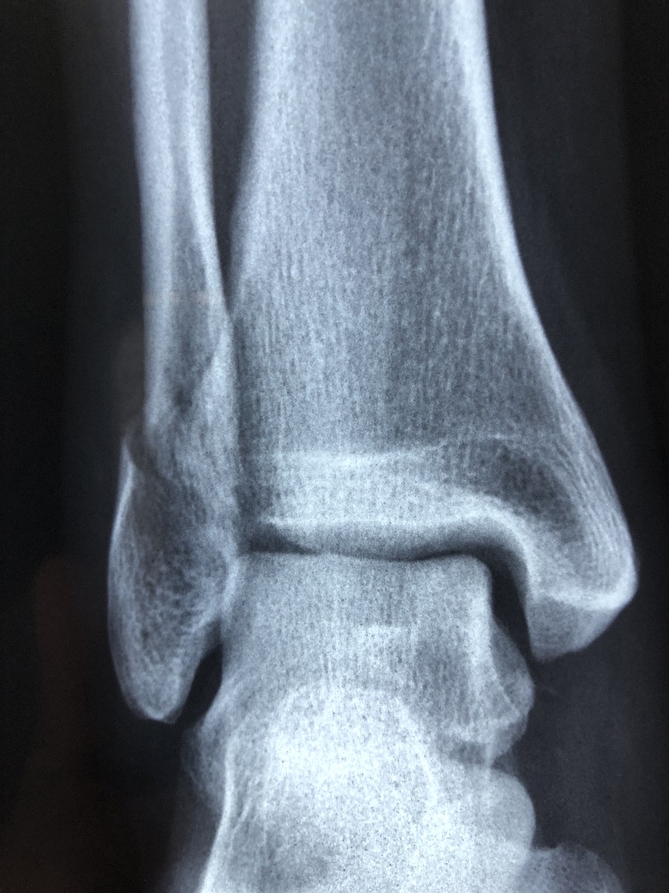 Unwind Knee Pain: Find Top Chiropractor Near You Now